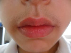 Shaving, in particular, can exacerbate this because, unlike tweezing or waxing, it does not remove hair at the follicle. How to remove upper lip hair naturally, get rid, home ...