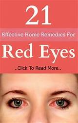 Holistic Cure For Dry Eyes Photos
