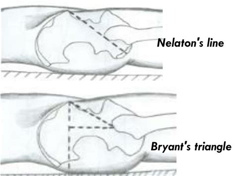 We did not find results for: PPT - Musculoskeletal tb hip joint FIRM III orthopaedic ...