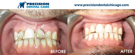 3014 n pulaski rd, chicago, il 60641. Precision Dental Care | The Best Dentists in Chicago IL