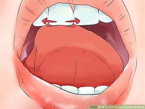 With a clean tissue, gauze, or piece of paper towel, grip the tooth. How to Pull a Loose Tooth at Home: 11 Steps (with Pictures)