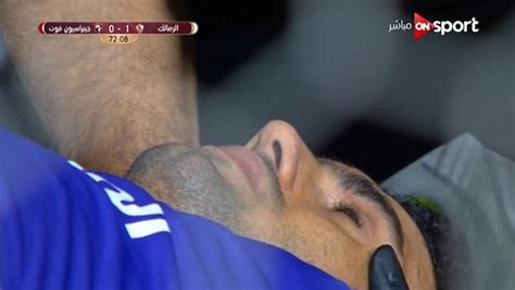 اثار محمد عواد حارس مرمى نادى الزمالك الجدل قبل ساعات من مواجهة الفريق الابيض امام مصر المقاصة فى الدورى المصرى الممتاز مساء السبت. إصابة خطيرة لعواد حارس الزمالك أمام جينيراسيون | الشرقية توداي