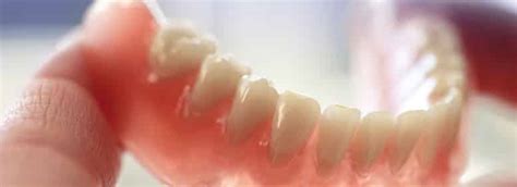 Due to changes in the gums and bone following tooth extraction and healing, immediate dentures may require relining or replacement to fit properly. dentures_partial | Uplus Dental