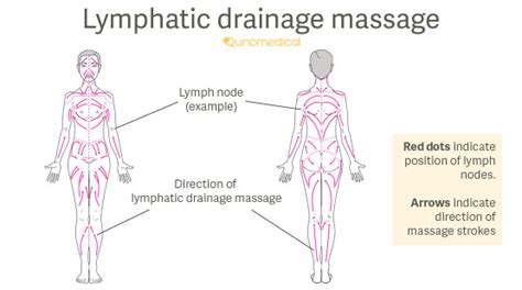 Lymphatic massage, also called lymphatic drainage or manual lymph drainage, is a technique developed in germany for treatment of lymphedema, an accumulation of fluid that can occur after. Lymphatic Drainage Massage | Qunomedical