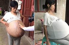 belly 44lbs grows thai mail