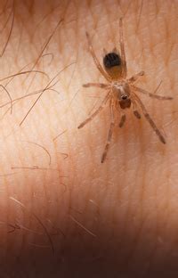 They only do it to defense if they are stimulated or attacked. Signs and Symptoms of a Poisonous Spider Bite | University ...