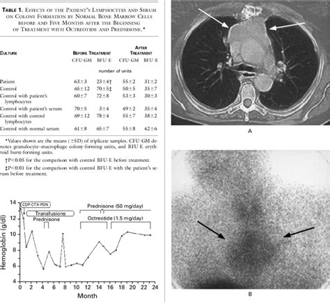 Do you like this video? Clinical Course of a Patient with a Thymoma and Pure Red ...