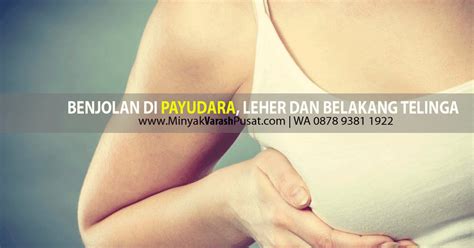 Gejala penyakit benjolan di payudara kiri : 2 Benjolan di Payudara Mengecil Pakai Obat Herbal Benjolan ...