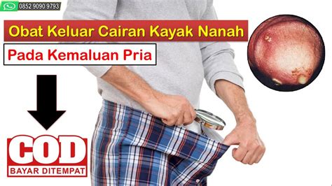 Jadi bila melakukan hubungan kelamin, darah ini boleh keluar dan berwarna coklat. Obat Keluar Cairan Kayak Nanah Pada Kemaluan Pria (Bayar ...