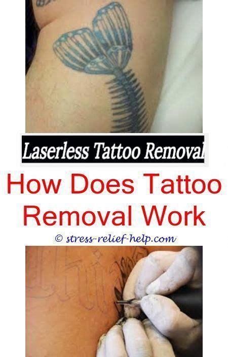 Just smear a dollop of cold cream on the tattoo and leave it for 10 minutes. Pin on Tattoo Removal