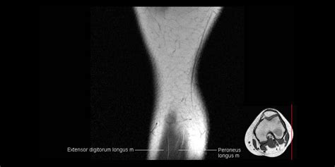 The journal of musculoskeletal medicine. Msk Mri Anatomy - Anatomy Drawing Diagram