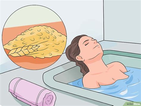 3 Modi per Alleviare il Prurito di una Scottatura da Sole ...