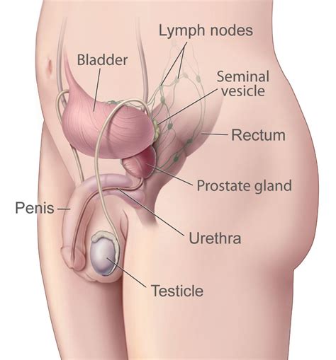 The cancer has spread to other parts of the body and the cancer cells observed under a microscope are poorly differentiated. prostate&hentai cosple CG spredpussy