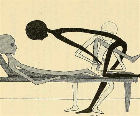 Der begriff adnexe wird als zusammenfassende bezeichnung für die anhangsgebilde der urogenitalregion oder für. Gynecological Gymnastics from Outer Space (1895) - The ...