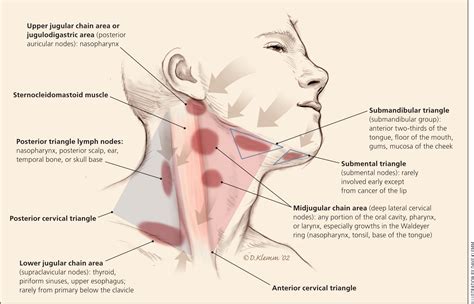 Jan 27, 2020 · most typically, swollen lymph nodes are related to a minor infection that the immune system is fighting. Swollen node in neck painful.