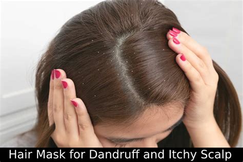 Hair Mask for Dandruff and Itchy Scalp - Causes and Amazing Hair Masks
