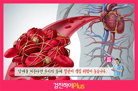 간단히 백신의 작동원리(기전)에 대해 설명드리면, chadox1 viral vector(전달물질)에 코로나 바이러스(사백신)을 주입하여 사람 몸에 주입합니다. 혈전 : í⃜ˆê´€ ì† ì‹œí•œí ­íƒ„ í⃜ˆì „ì ⃜ ëª¨ë ...