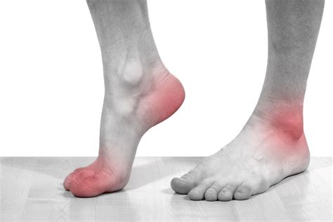 The foot is an intricate part of the body, consisting of 26 bones, 33 joints, 107 ligaments, and 19 muscles. Foot Arch Pain Treatment and Diagnosis | Common Foot Pain Problems