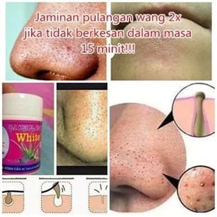 Buang blackhead whitehead guna barang di rumah semudah abc. FAIZAL e-MARKETING (UT0017960-U): MASK VIETNAM