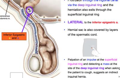 Conclusions about inguinal hernias in female patients are difficult to draw because most of the literature involves male patients. Inguinal Region, Testes, and Scrotum at Ross University School of Medicine - StudyBlue