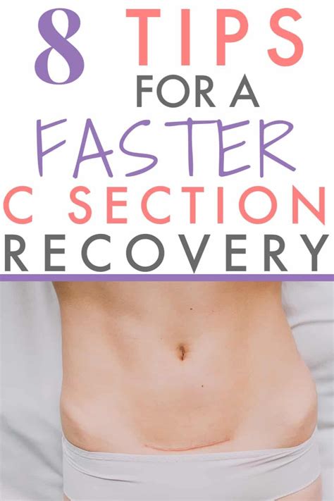 What to expect after a vaginal birth. 8 C-SECTION RECOVERY TIPS FOR THE NEW MOM - forgotten ...