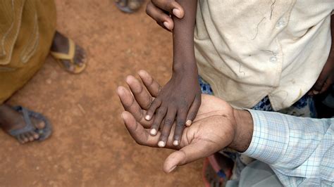 UNICEF : 225 000 enfants souffrent de malnutrition dans les régions d ...