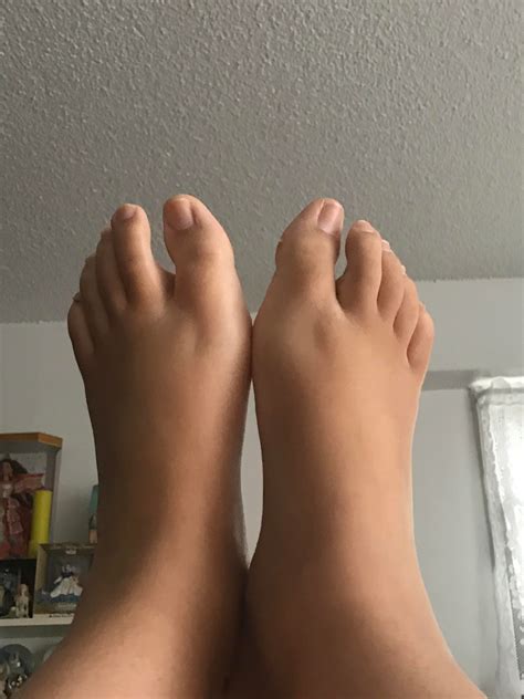 Muscle atrophy in the feet? Is it even possible for atrophy to appear ...