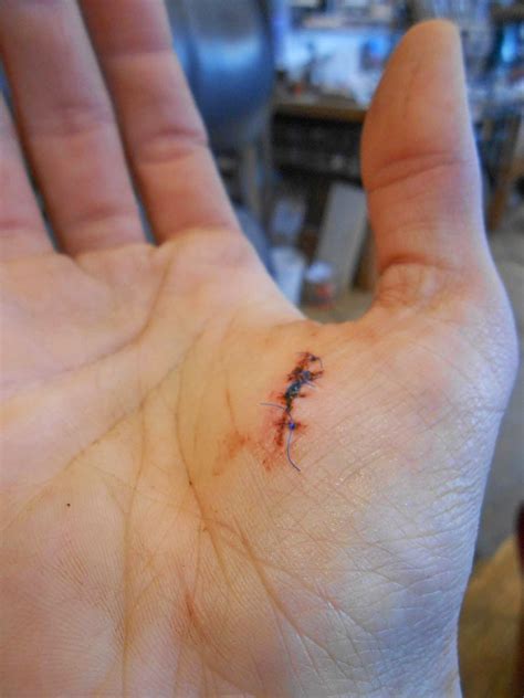 I am going to teach you grammar and you are going to like it. Chronicles of a Woodworking Apprentice: Splinter Stitches