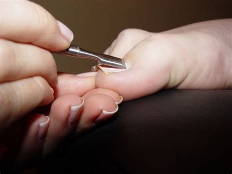 However, the signs and symptoms of. Ingrown Toenail Treatment: Natural ingrown toenail treatment