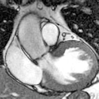 Eine entzündung des herzmuskels ist eine gefährliche komplikation von infekten. Kardiologie - Herz-Kreislauf-Erkrankung frühzeitig erkennen