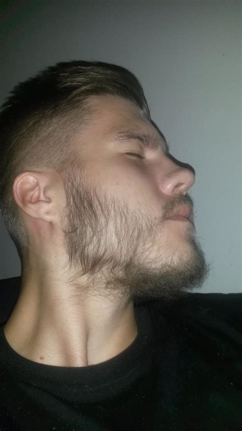 Moving on we have this gentleman, like the previous subject, this man started off with not much facial hair but things drastically minoxidil before and after. Minoxidil Beard Reddit | Beard Style Corner