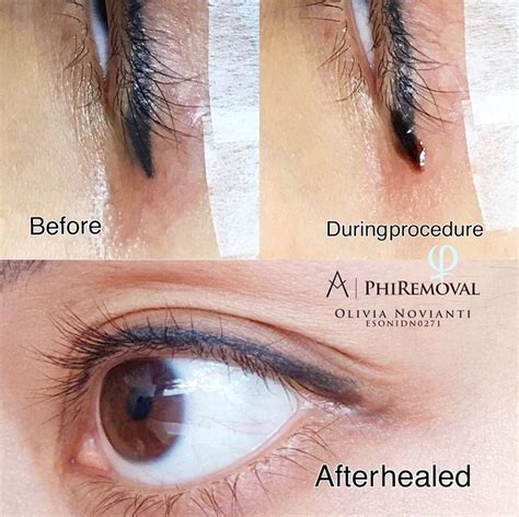 First, shake the liquid eyeliner and draw a thinner line to your eyelid, wait for 15 seconds to dry completely, then apply again to make the liner thick and the eyelashes adhere well q2: Pin by Ella Sakalauskiene on Eyeliner Removal | Eyeliner ...