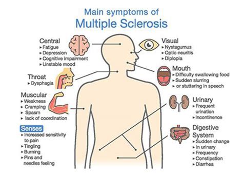 Multiple sclerosis can cause a variety of symptoms: Massage for Multiple Sclerosis (MS) | Learn More & Book ...