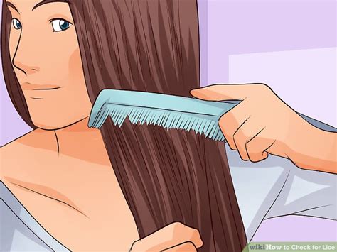 Buy at a drugstore a suitable lotion or shampoo. How to Check for Lice (with Pictures) - wikiHow