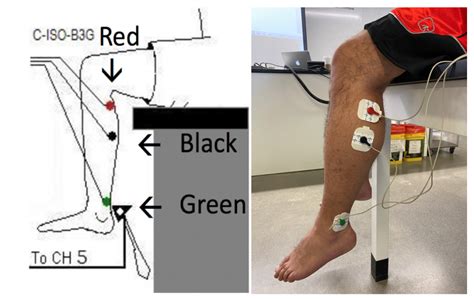 The deep tendon reflex arc is divided into the upper motor neuron (umn) component and the lower motor neuron (lmn) component. 2.7: Patellar and Achilles Reflexes - Medicine LibreTexts