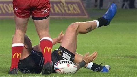 If your knee is dislocated, your thigh and shin bones may be completely or partially out of place. Rugby Tough: Calmly popping your dislocated knee back in ...