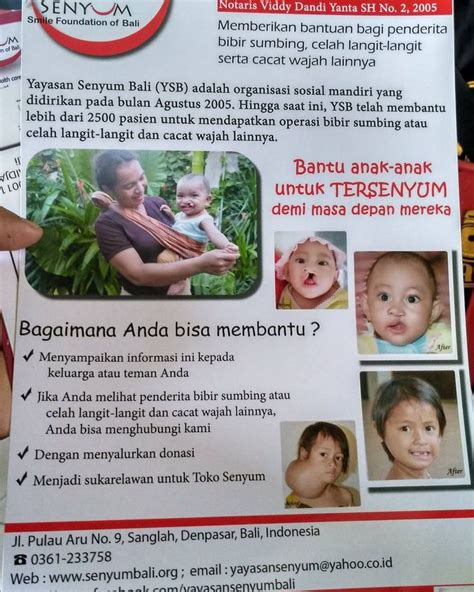 Pada langit ini dapat dibagi menjadi dua bagian yang sangat berbeda. Jika menemukan anak dengan bibir sumbing atau tanpa langit ...