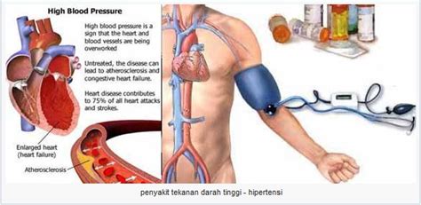 Check spelling or type a new query. Manfaat Rambut Jagung Bisa Menangani Diabetes, Darah ...