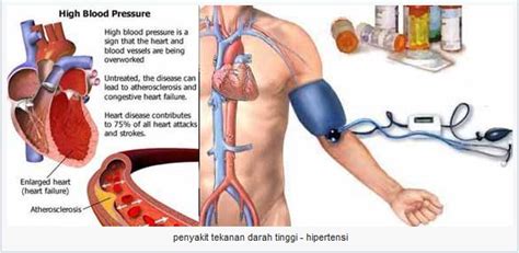 Check spelling or type a new query. Manfaat Rambut Jagung Bisa Menangani Diabetes, Darah ...