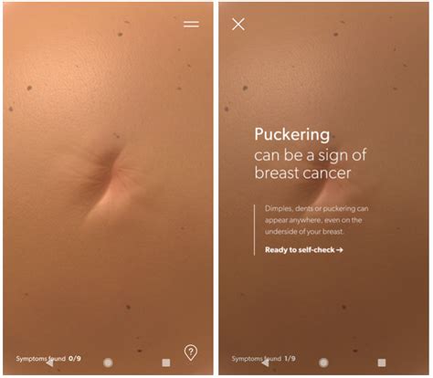 Breast cancer starts when normal cells transform into cancerous cells and these breast cells begin to grow out of control. Breast Cancer Foundation - Pre Check app to look for ...