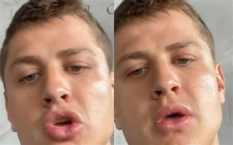 Lucas contesta estratégia de nego di. Ex-BBB Lucas Gallina exibe resultado de preenchimento ...