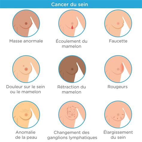 Chez la femme, le cancer du sein est toujours le plus mortel, suivi de près par le cancer du poumon et le cancer colorectal. Cancer du sein : comment reconnaitre les symptômes ...