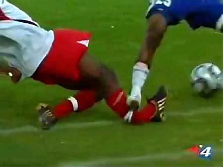 Athletes who have been injured are usually advised to limit their activities until their injuries are healed. Is This The Worst Leg Break In Football History? - Sick ...