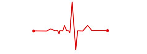 Elektrokardiogramm) handelt es sich um die untersuchung der. Elektrokardiogramm (EKG) - Internisten Duderstadt