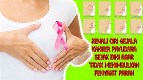 Benjolan menjadi tanda utama pada kanker payudara baik pada pria ataupun perempuan. INI DIA !!! CIRI TANDA TIMBULNYA PENYAKIT KANKER PAYUDARA ...