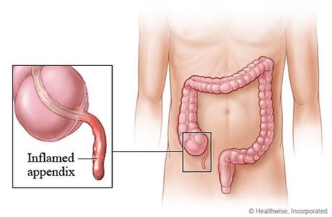 Maybe you would like to learn more about one of these? 10 Useless Human Body Parts - Seven Wonders of the World