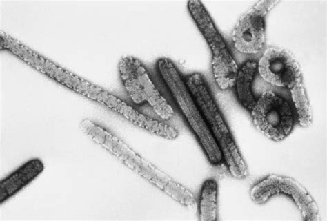 What are the differences between these two deadly viruses? microBIO: Ébola-Marburg, virus mortíferos: encuentran el ...