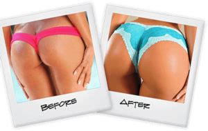 Get wider hips & bigger butt: How to Make Your Buttocks Bigger Fast & Naturally ...