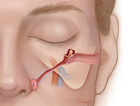 Picture of the structures of the inner ear and eustachian tubes the primary function of the eustachian tube is to ventilate the middle ear space, ensuring that its pressure remains at near normal environmental air pressure. Eustachian Tuboplasty - Oto Surgery Atlas