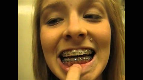 So when it comes to eating with braces or invisalign, you want to make sure you're making healthy choices while also protecting your teeth! Braces: Answering Your questions 4 Elastics - YouTube